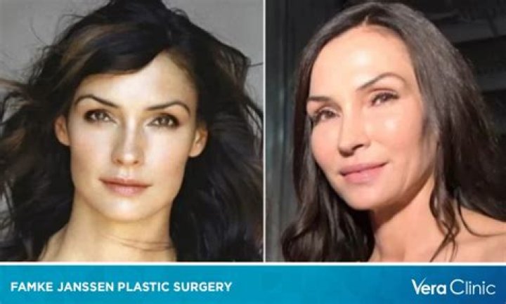 Fans Speculate Famke Janssen’s Possible Plastic Surgery Despite Her Silence