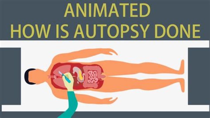Fit For An Autopsy Net Worth - How Much Does Fit For An Autopsy Make?