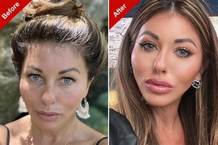 Has Ashley Tervort Done Plastic Surgery? Bio