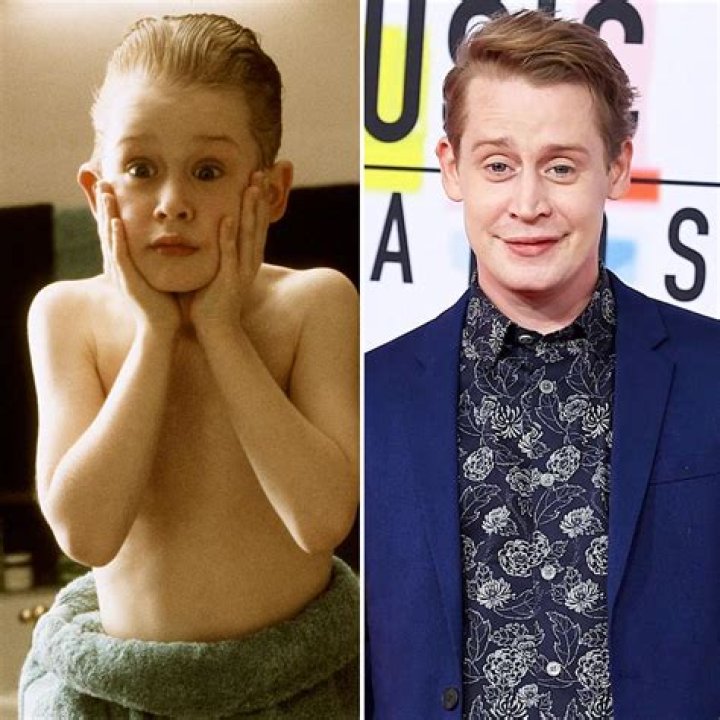 Macaulay Culkin Then And Now: Weight Loss Journey
