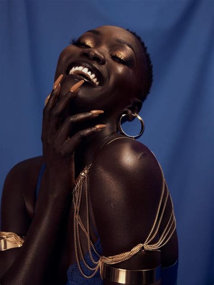 Nyakim Gatwech Freak Of Nature, Bio, Wiki, Age, Height, Husband, And Net Worth