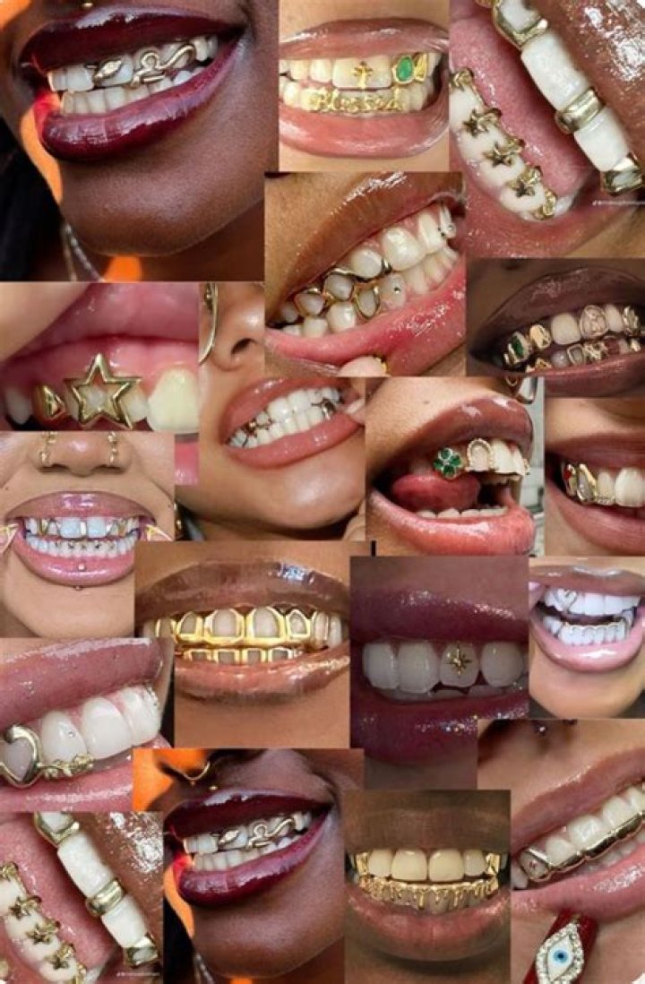 The Golden History of Golden Teeth and Grillz: Adding One More Reason to Smile